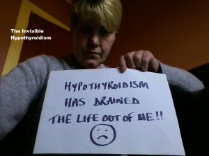 'Hypothyroidism has drained the life out of me'