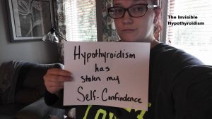 'Hypothyroidism has stole my self-confidence'