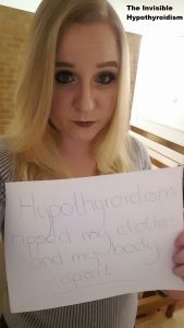 'Hypothyroidism ripped my clothes and my body apart'