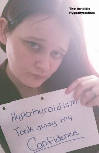 'Hypothyroidism took away my confidence'
