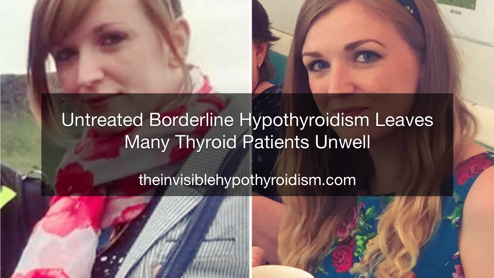 Untreated 'Borderline Hypothyroidism' Leaves Many Thyroid Patients Unwell