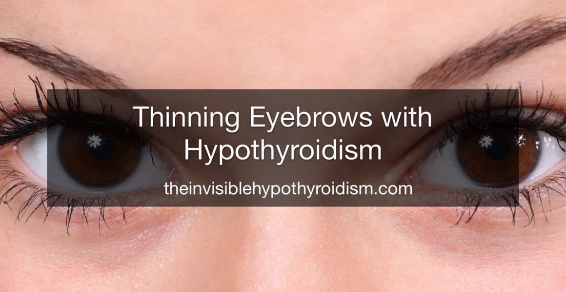 Thinning Eyebrows with Hypothyroidism