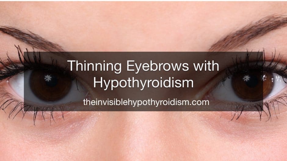 Thinning Eyebrows with Hypothyroidism
