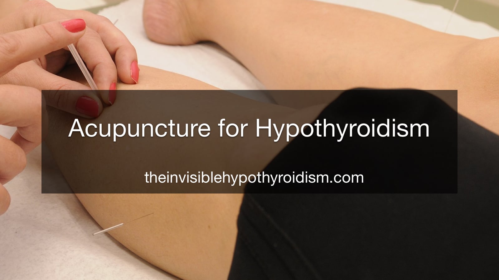 Acupuncture for Hypothyroidism
