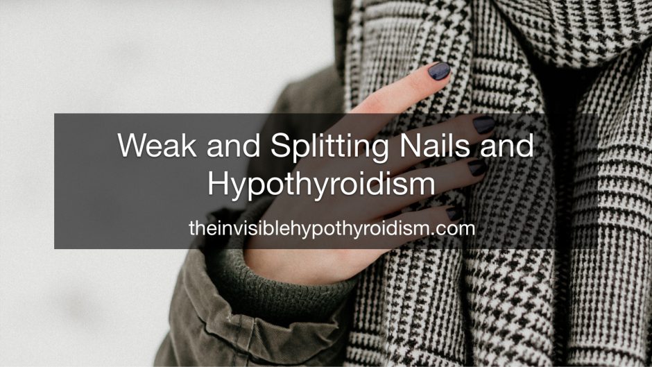 Weak and Splitting Nails and Hypothyroidism 