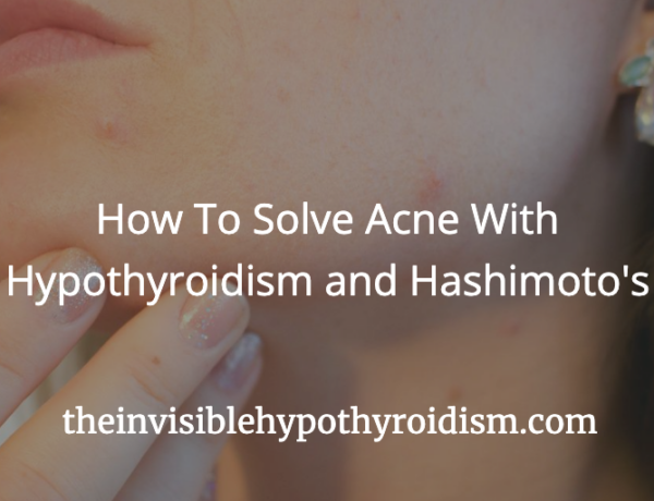 How To Solve Acne With Hypothyroidism and Hashimoto's