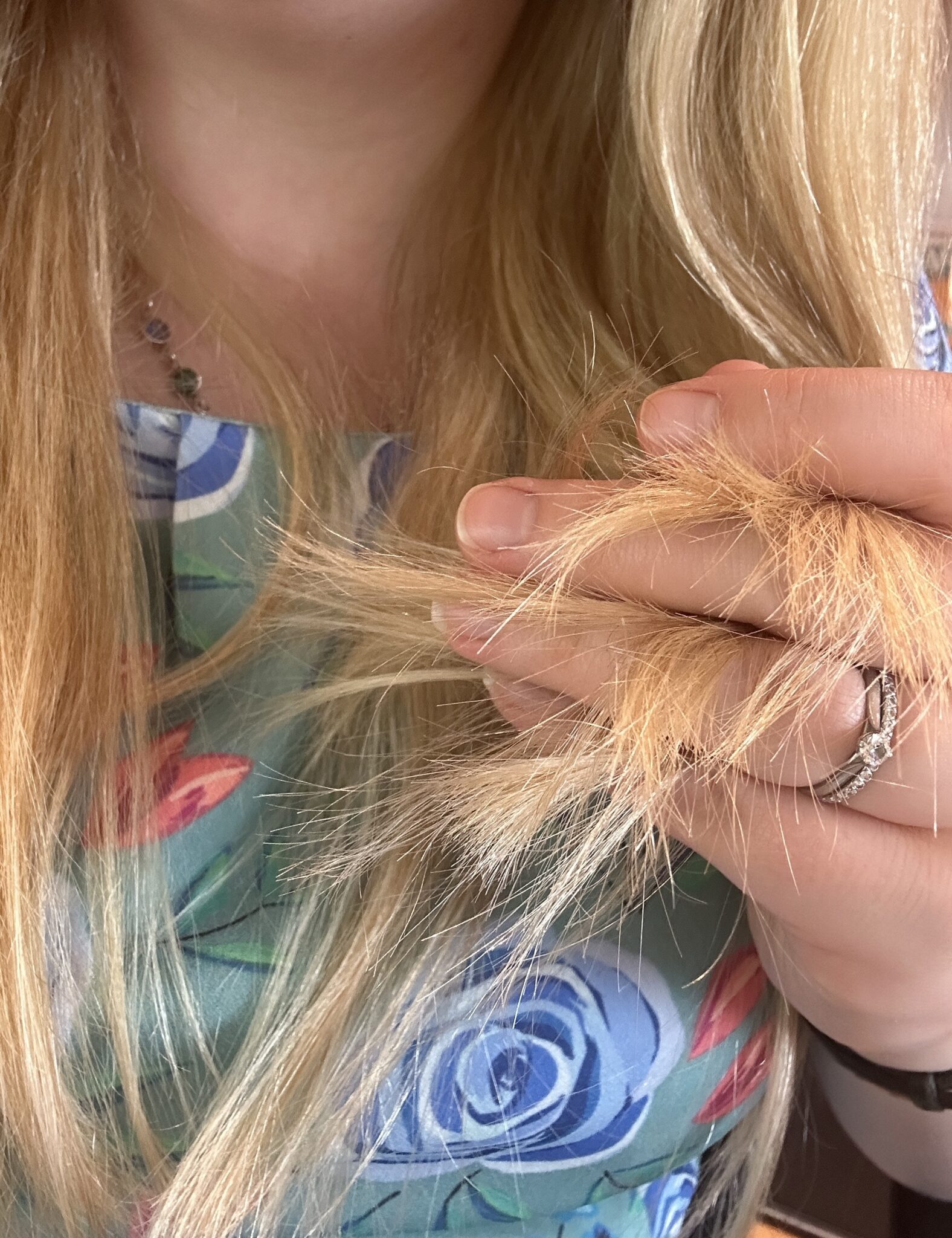 Brittle and Dry Hair With Hypothyroidism and Hashimoto’s The